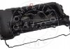 Купити Кришка клапанів Mini Cooper Cabrio (R57)/One (R56) 1.4-1.6 07-16 (з прокладкою) Mini Cooper, Countryman, Clubman AIC 58089 (фото1) підбір по VIN коду, ціна 4279 грн.