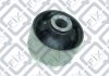 Купити Сайлентблок переднього важеля (задній) KIA Magentis Q-fix q005-3559 (фото1) підбір по VIN коду, ціна 245 грн.